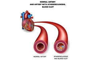 Blood Pressure tracking